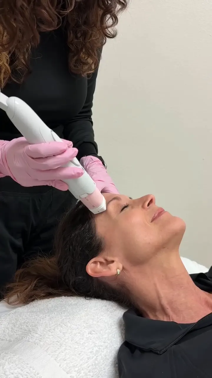 A GLO provider in pink gloves gliding the Everesse radiofrequency handpiece across a relaxed client's forehead in Ocala